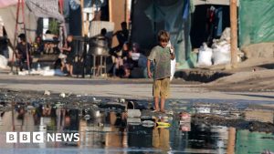 4 Diseases spread in Gaza as sewage contaminates